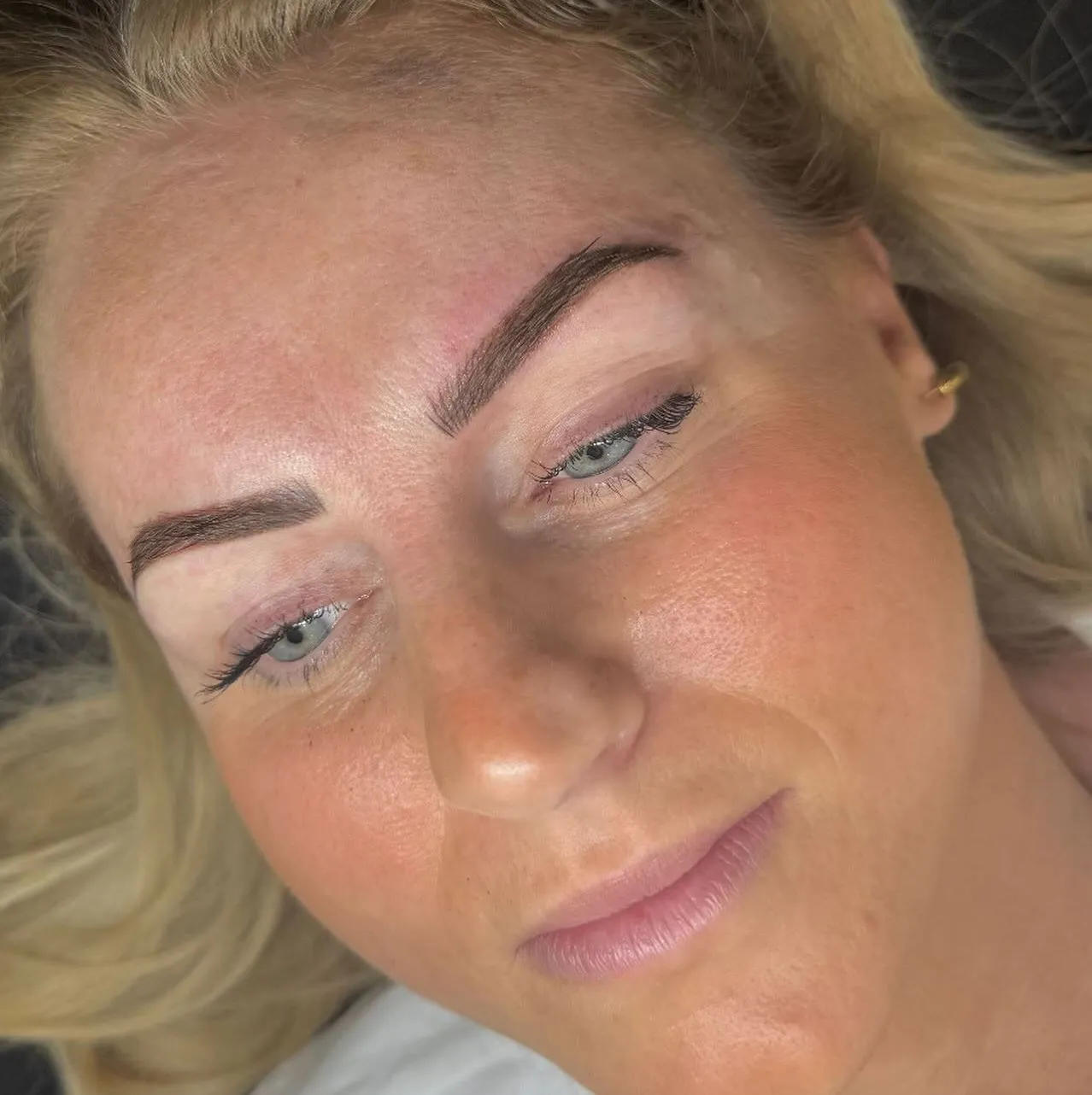 Brow correction demand is up